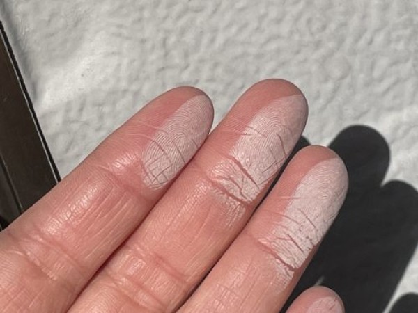 外壁に剥がれが見られるお宅で建物調査サムネイル