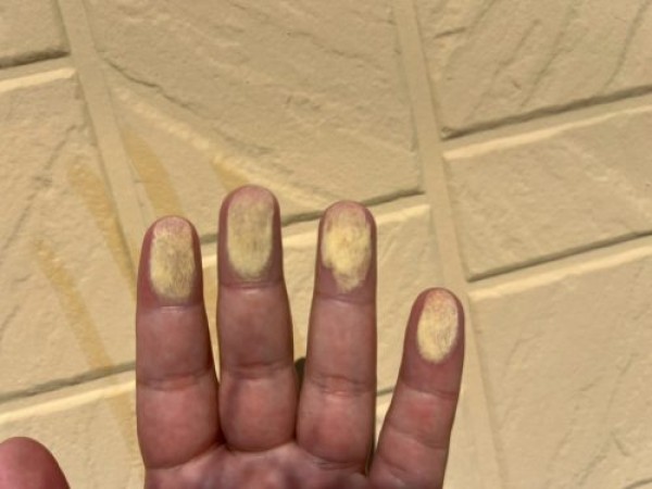 【尾張旭市】外壁塗装のご提案, チョーキングやシーリング劣化の調査事例サムネイル